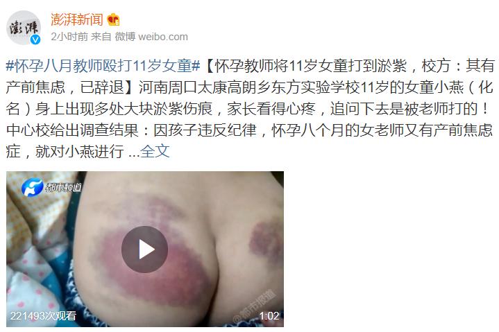 怀孕教师殴打女童具体情况介绍